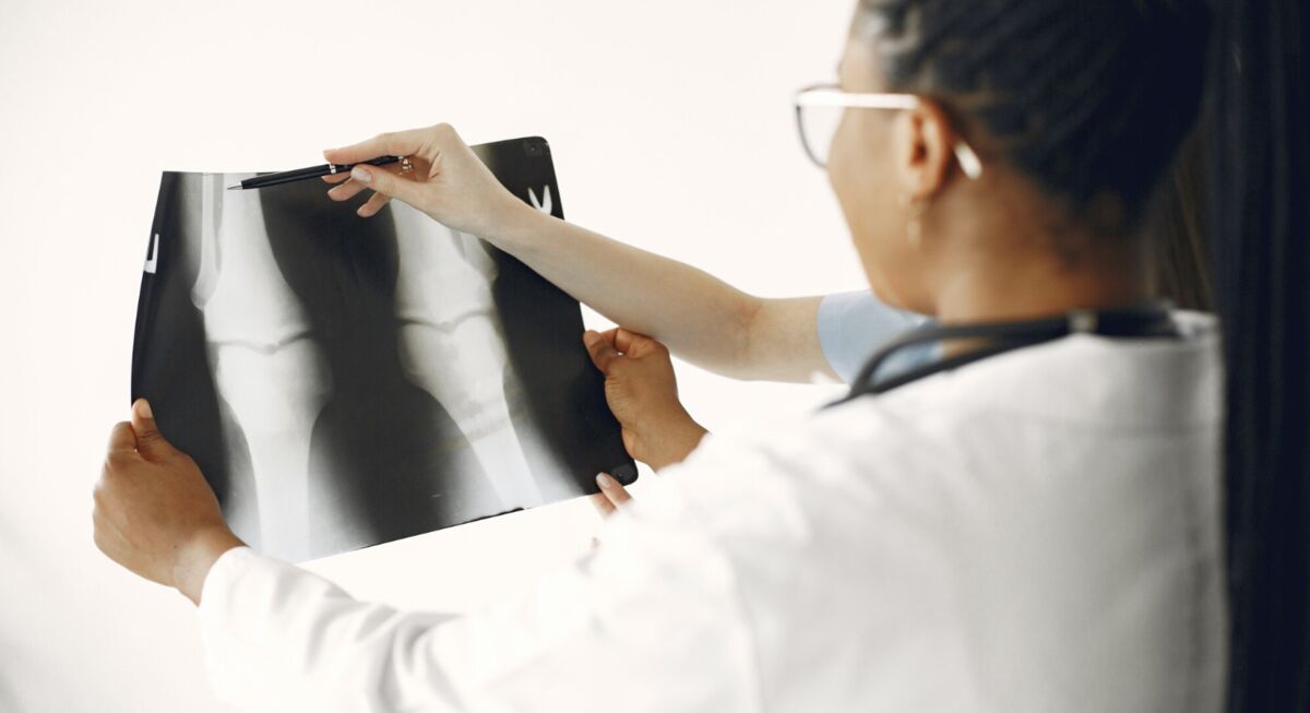 Médico analisando radiografia - como fortalecer os ossos