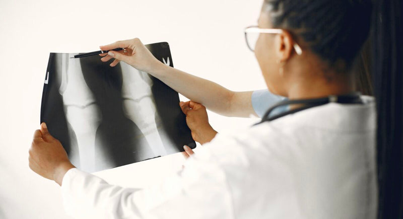 Médico analisando radiografia de joelho